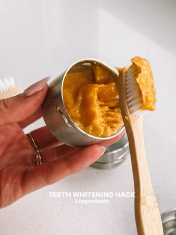 teeth whitening hack